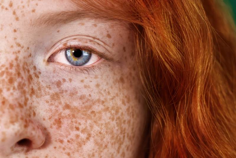 Przyczyny atopowego zapalenia skóry na fotografiach – analiza problemu