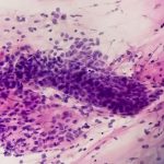 Analiza moczu u przyszłych mam - rezultaty i osad